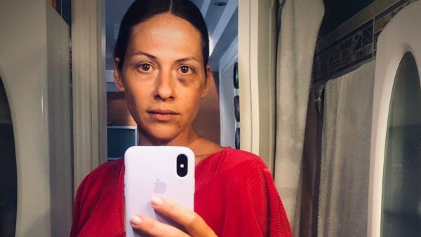 Μαρία Δεληθανάση: Η νέα φωτογραφία για την καταγγελία ξυλοδαρμού της από τον Κώστα Δόξα