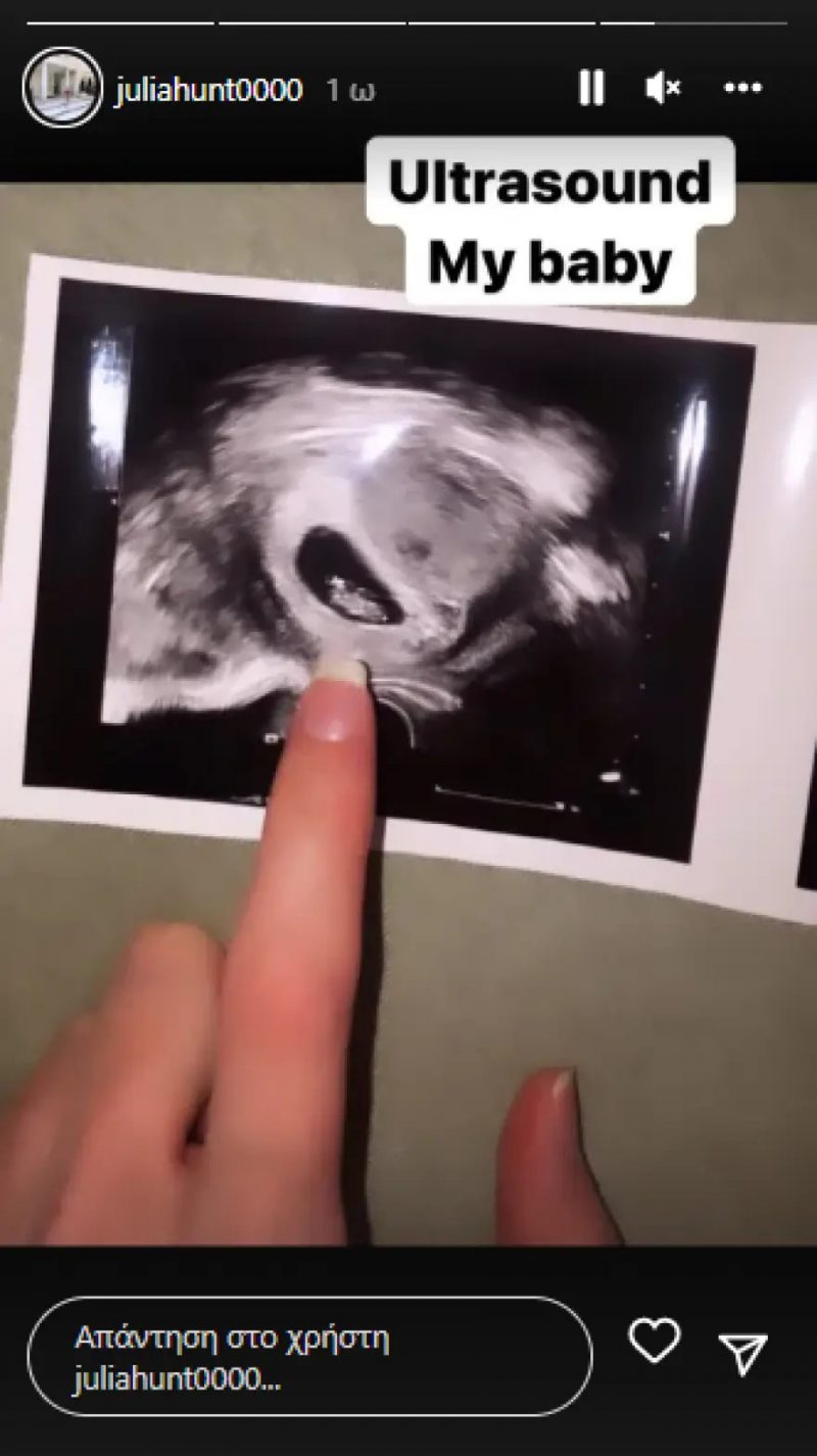 «Η εγκυμοσύνη δεν αντέχεται»: Η πρώτη ανάρτηση της εγκυμονούσας Τζούλιας Αλεξανδράτου με μαγιό (Pic)